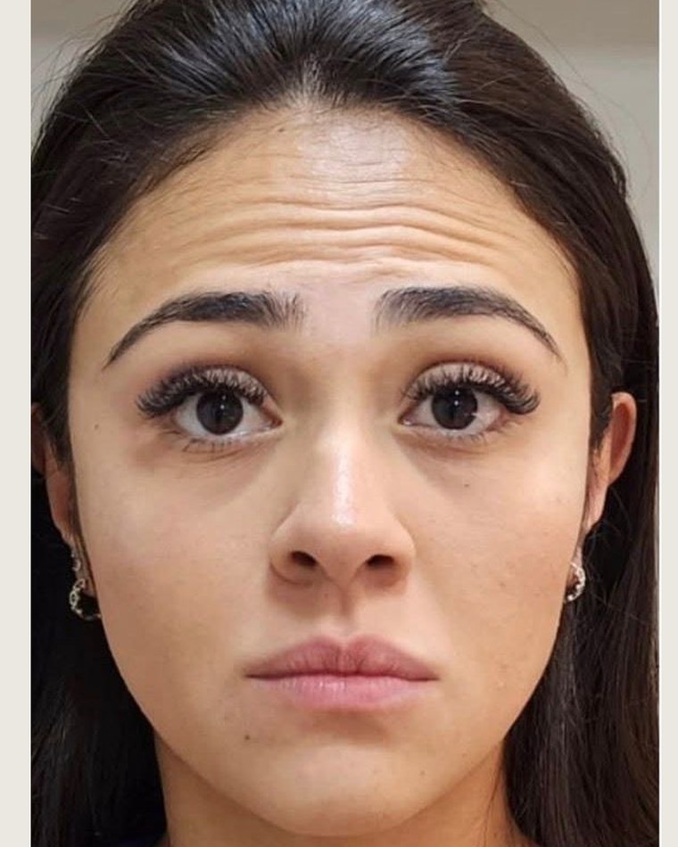 Antes