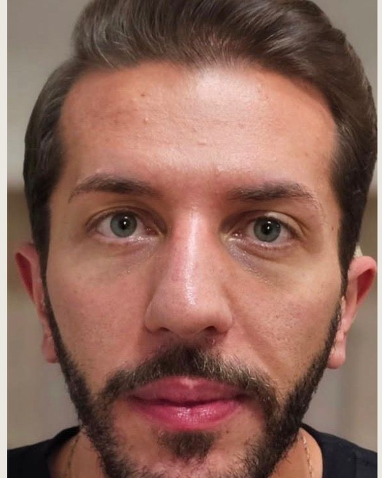 Antes